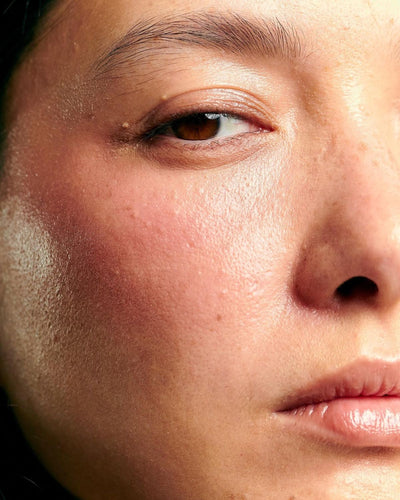 Les 4 signes que votre peau manque d’hydratation (et comment y remédier avec LH BEAUTY)